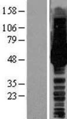 Western Blot: HS1BP3 Overexpression Lysate (Adult Normal) [NBL1-11711] Left-Empty vector transfected control cell lysate (HEK293 cell lysate); Right -Over-expression Lysate for HS1BP3.