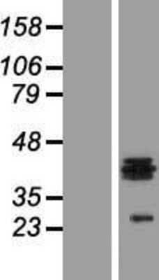 Western Blot: HS3ST1 Overexpression Lysate (Adult Normal) [NBL1-11713] Left-Empty vector transfected control cell lysate (HEK293 cell lysate); Right -Over-expression Lysate for HS3ST1.