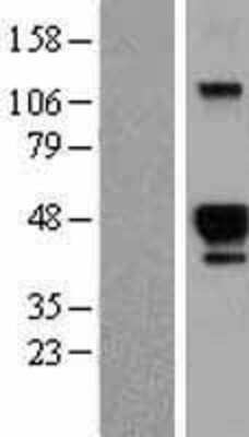 Western Blot: HS3ST2 Overexpression Lysate (Adult Normal) [NBL1-11714] Left-Empty vector transfected control cell lysate (HEK293 cell lysate); Right -Over-expression Lysate for HS3ST2.