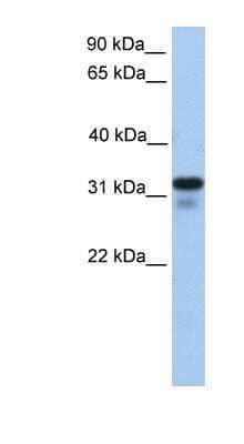 Western Blot: HS3ST6 Antibody [NBP1-91324] - 721_B cell lysate, concentration 0.2-1 ug/ml.