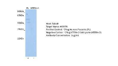 Western Blot: HS3ST6 Antibody [NBP1-91324] - Host: Rabbit. Target: HS3ST6. Positive control (+): Human Placenta (PL). Negative control (-): NTERA-2 Cell Lysate (N27). Antibody concentration: 1ug/ml