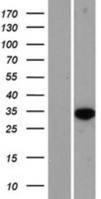 Western Blot: HS3ST6 Overexpression Lysate (Adult Normal) [NBP2-08707] Left-Empty vector transfected control cell lysate (HEK293 cell lysate); Right -Over-expression Lysate for HS3ST6.