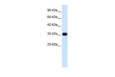 Western Blot: HS747E2A Antibody [NBP2-87603] - WB Suggested Anti-HS747E2A Antibody Titration: 1.25ug/ml. ELISA Titer: 1:500. Positive Control: HepG2 cell lysate