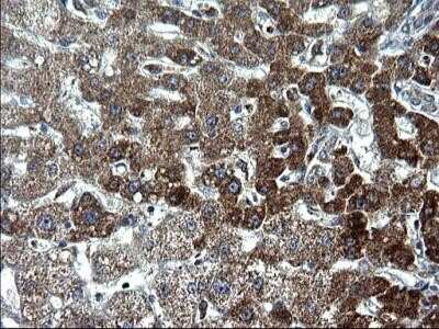 Immunohistochemistry: HSCB Antibody (OTI3E1) - Azide and BSA Free [NBP2-72415] - Analysis of Human liver tissue. (Heat-induced epitope retrieval by 1 mM EDTA in 10mM Tris, pH8.5, 120C for 3min)