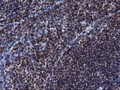 Immunohistochemistry: HSCB Antibody (OTI3E1) - Azide and BSA Free [NBP2-72415] - Analysis of Human lymph node tissue. (Heat-induced epitope retrieval by 1 mM EDTA in 10mM Tris, pH8.5, 120C for 3min)