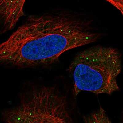 Immunocytochemistry/ Immunofluorescence HSD11B1L Antibody - BSA Free
