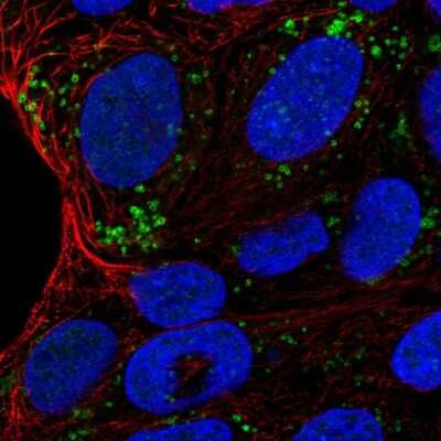 Immunocytochemistry/Immunofluorescence: HSD11B2 Antibody [NBP2-37954] - Immunofluorescent staining of human cell line RT4 shows localization to vesicles.