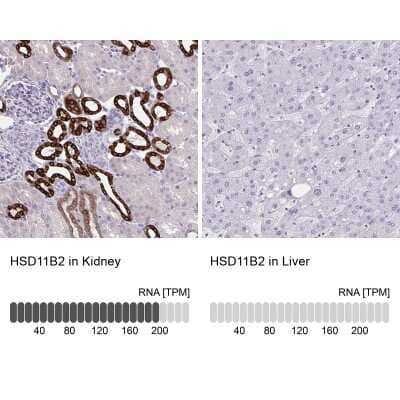 Immunohistochemistry-Paraffin: HSD11B2 Antibody [NBP2-37898] - Staining in human kidney and liver tissues using anti-HSD11B2 antibody. Corresponding HSD11B2 RNA-seq data are presented for the same tissues.