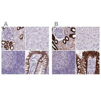 Immunohistochemistry-Paraffin: HSD11B2 Antibody [NBP2-37898] - Staining of human kidney, liver, lymph node and rectum using Anti-HSD11B2 antibody NBP2-37898 (A) shows similar protein distribution across tissues to independent antibody NBP2-37954 (B).