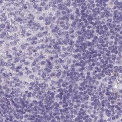 Immunohistochemistry-Paraffin: HSD11B2 Antibody [NBP2-37898] - Staining of human lymph node.