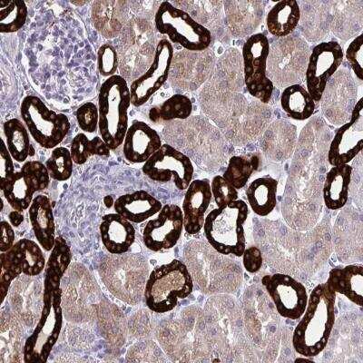 Immunohistochemistry-Paraffin: HSD11B2 Antibody [NBP2-37954] - Staining of human kidney shows high expression.