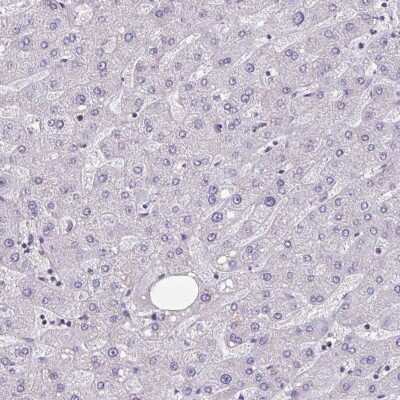 Immunohistochemistry-Paraffin: HSD11B2 Antibody [NBP2-37954] - Staining of human liver shows low expression as expected.