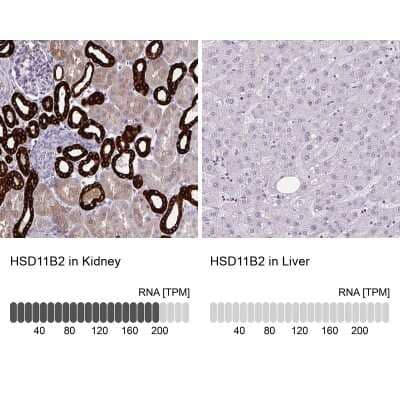 Immunohistochemistry-Paraffin: HSD11B2 Antibody [NBP2-37954] - Staining in human kidney and liver tissues using anti-HSD11B2 antibody. Corresponding HSD11B2 RNA-seq data are presented for the same tissues.