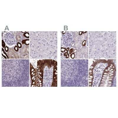 <b>Independent Antibodies Validation and Orthogonal Strategies Validation.</b>Immunohistochemistry-Paraffin: HSD11B2 Antibody [NBP2-37954] - Staining of human kidney, liver, lymph node and rectum using Anti-HSD11B2 antibody NBP2-37954 (A) shows similar protein distribution across tissues to independent antibody NBP2-37898 (B).