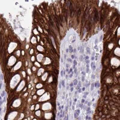 Immunohistochemistry-Paraffin: HSD11B2 Antibody [NBP2-37954] - Staining of human rectum.