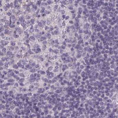 Immunohistochemistry-Paraffin: HSD11B2 Antibody [NBP2-37954] - Staining of human lymph node.