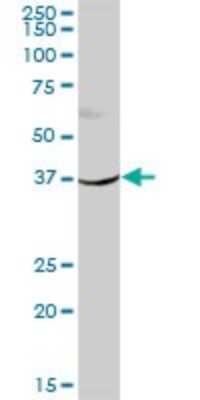Western Blot: HSD11B2 Antibody [H00003291-B01P] - Analysis of HSD11B2 expression in human colon.