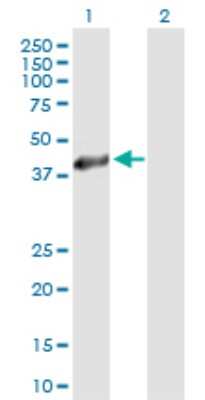 Western Blot: HSD11B2 Antibody [H00003291-B01P] - Analysis of HSD11B2 expression in transfected 293T cell line by HSD11B2 polyclonal antibody.  Lane 1: HSD11B2 transfected lysate(44.55 KDa). Lane 2: Non-transfected lysate.