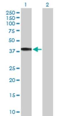 Western Blot: HSD11B2 Antibody [H00003291-D01P] - Analysis of HSD11B2 expression in transfected 293T cell line by HSD11B2 polyclonal antibody.Lane 1: HSD11B2 transfected lysate(44.10 KDa).Lane 2: Non-transfected lysate.