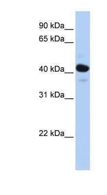 Western Blot: HSD11B2 Antibody [NBP1-53163] - Human Muscle lysate, concentration 0.2-1 ug/ml.