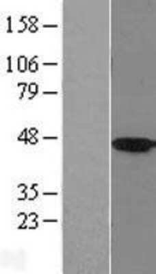 Western Blot: HSD11B2 Overexpression Lysate (Adult Normal) [NBL1-11721] Left-Empty vector transfected control cell lysate (HEK293 cell lysate); Right -Over-expression Lysate for HSD11B2.