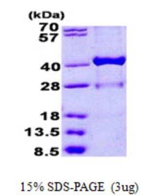 SDS-Page: HSD17B1 Protein [NBP2-23127]