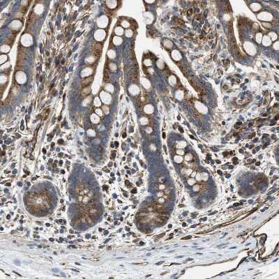 Immunohistochemistry-Paraffin: HSD17B12 Antibody [NBP1-81567] - Staining of human colon shows moderate to strong cytoplasmic positivity in glandular cells.