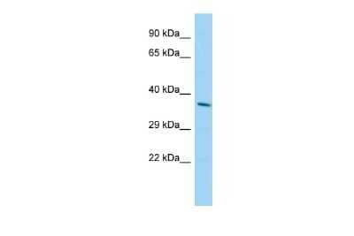 Western Blot: HSD17B12 Antibody [NBP2-87604] - Host: Rabbit. Target Name: Hsd17b12. Sample Type: Mouse Testis lysates. Antibody Dilution: 1.0ug/ml