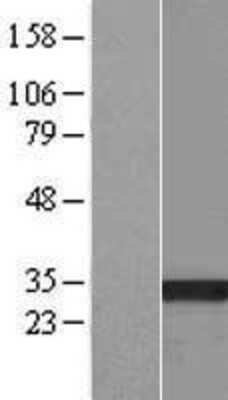 Western Blot: HSD17B13 Overexpression Lysate (Adult Normal) [NBP2-04969] Left-Empty vector transfected control cell lysate (HEK293 cell lysate); Right -Over-expression Lysate for HSD17B13.