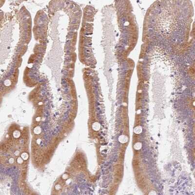 Immunohistochemistry: HSD17B2 Antibody [NBP2-48956] - Staining of human small intestine shows strong cytoplasmic positivity in glandular cells.