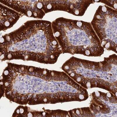 Immunohistochemistry-Paraffin: HSD17B2 Antibody [NBP1-92011] - Staining of human duodenum shows moderate to strong cytoplasmic positivity in glandular cells.