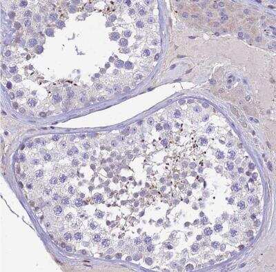 Immunohistochemistry-Paraffin: HSD17B2 Antibody [NBP1-92011] -  Staining of human testis shows no positivity in cells in seminiferous ducts as expected.