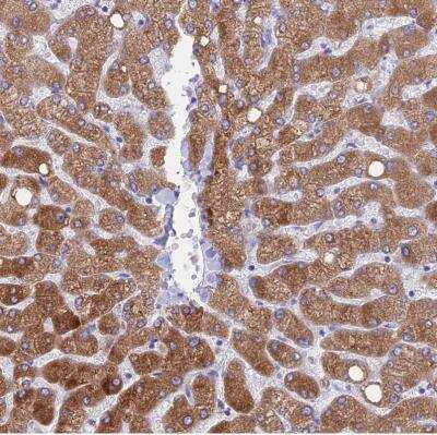 Immunohistochemistry-Paraffin: HSD17B2 Antibody [NBP1-92011] - Staining of human liver shows moderate to strong cytoplasmic positivity in hepatocytes.