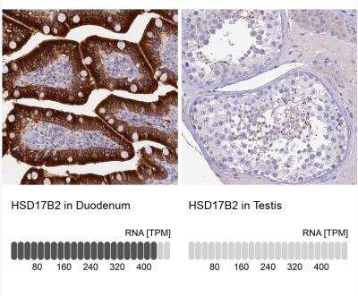 Immunohistochemistry-Paraffin: HSD17B2 Antibody [NBP1-92011] - Analysis in human duodenum and testis tissues.  Corresponding HSD17B2 RNA-seq data are presented for the same tissues.