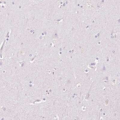 Immunohistochemistry-Paraffin: HSD17B2 Antibody [NBP2-48956] - Staining of human cerebral cortex shows low expression as expected.