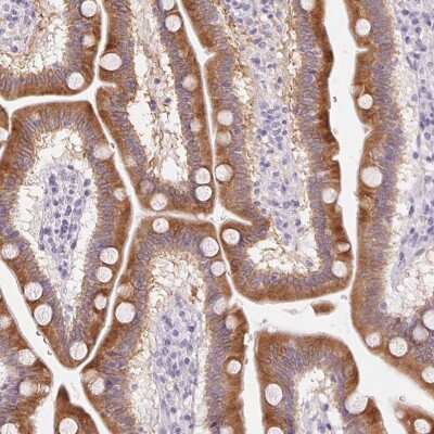 Immunohistochemistry-Paraffin: HSD17B2 Antibody [NBP2-48956] - Staining of human duodenum shows high expression.