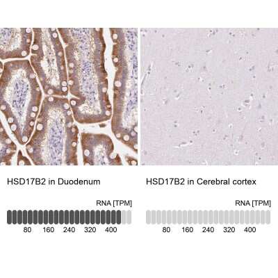 <b>Orthogonal Strategies Validation. </b>Immunohistochemistry-Paraffin: HSD17B2 Antibody [NBP2-48956] - Staining in human duodenum and cerebral cortex tissues using anti-HSD17B2 antibody. Corresponding HSD17B2 RNA-seq data are presented for the same tissues.