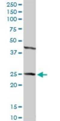 Western Blot: HSD17B2 Antibody [H00003294-D01P] - Analysis of HSD17B2 expression in mouse kidney.