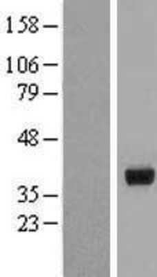 Western Blot: HSD17B2 Overexpression Lysate (Adult Normal) [NBL1-11726] Left-Empty vector transfected control cell lysate (HEK293 cell lysate); Right -Over-expression Lysate for HSD17B2.