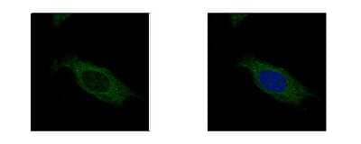 Immunocytochemistry/ Immunofluorescence HSD17B3 Antibody