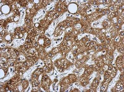 Immunohistochemistry-Paraffin HSD17B3 Antibody