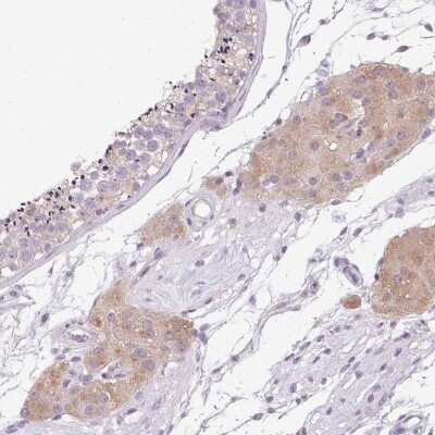 Immunohistochemistry-Paraffin: HSD17B3 Antibody [NBP2-38807] - Staining of human testis shows high expression.