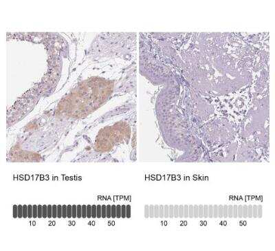 Immunohistochemistry-Paraffin HSD17B3 Antibody