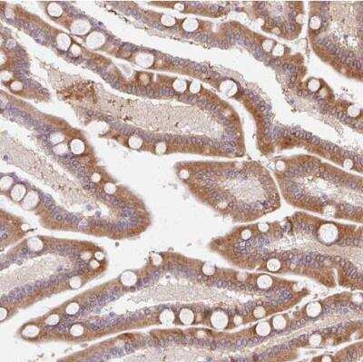 Immunohistochemistry-Paraffin: HSD17B3 Antibody [NBP2-38807] - Staining of human duodenum shows moderate cytoplasmic positivity in glandular cells.