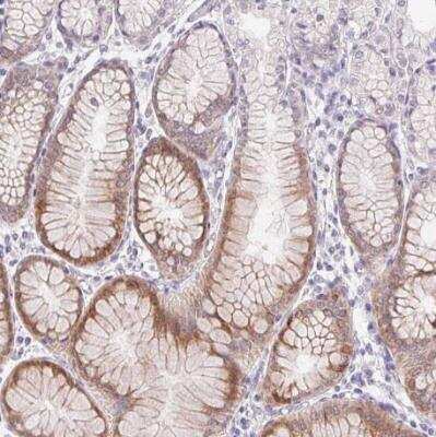 Immunohistochemistry-Paraffin: HSD17B3 Antibody [NBP2-38807] - Staining of human stomach shows moderate cytoplasmic positivity in glandular cells.