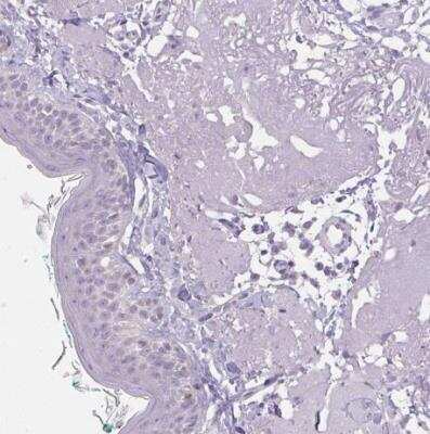 <b>Orthogonal Strategies Validation. </b>Immunohistochemistry-Paraffin: HSD17B3 Antibody [NBP2-38807] - Staining of human skin shows negative cytoplasmic positivity in keratinocytes as expected.