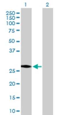 Western Blot: HSD17B3 Antibody [H00003293-D01P] - Analysis of HSD17B3 expression in transfected 293T cell line by HSD17B3 polyclonal antibody.Lane 1: HSD17B3 transfected lysate(34.50 KDa).Lane 2: Non-transfected lysate.