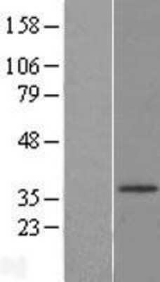 Western Blot HSD17B3 Overexpression Lysate