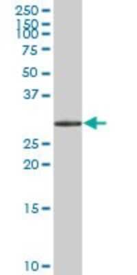 Western Blot: HSD17B6 Antibody [H00008630-B01P] - Analysis of HSD17B6 expression in human liver.