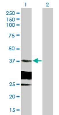 Western Blot: HSD17B6 Antibody [H00008630-B01P] - Analysis of HSD17B6 expression in transfected 293T cell line by HSD17B6 polyclonal antibody.  Lane 1: HSD17B6 transfected lysate(34.87 KDa). Lane 2: Non-transfected lysate.